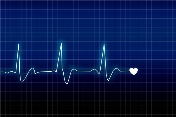 Điện tâm đồ nhồi máu cơ tim có ý nghĩa như thế nào?